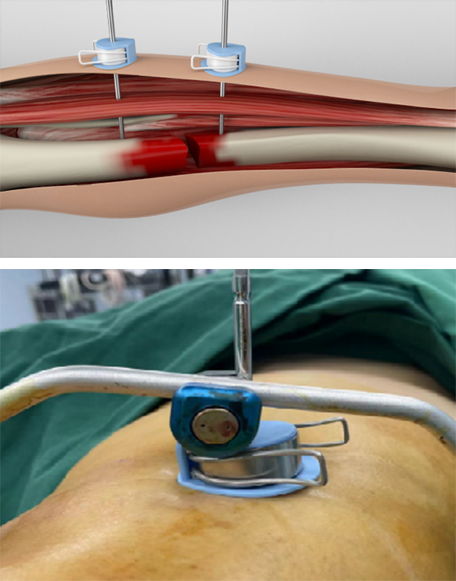 67a7699c7a4bb73c2d6801fb5110775.png 67a7699c7a4bb73c2d6801fb5110775.png